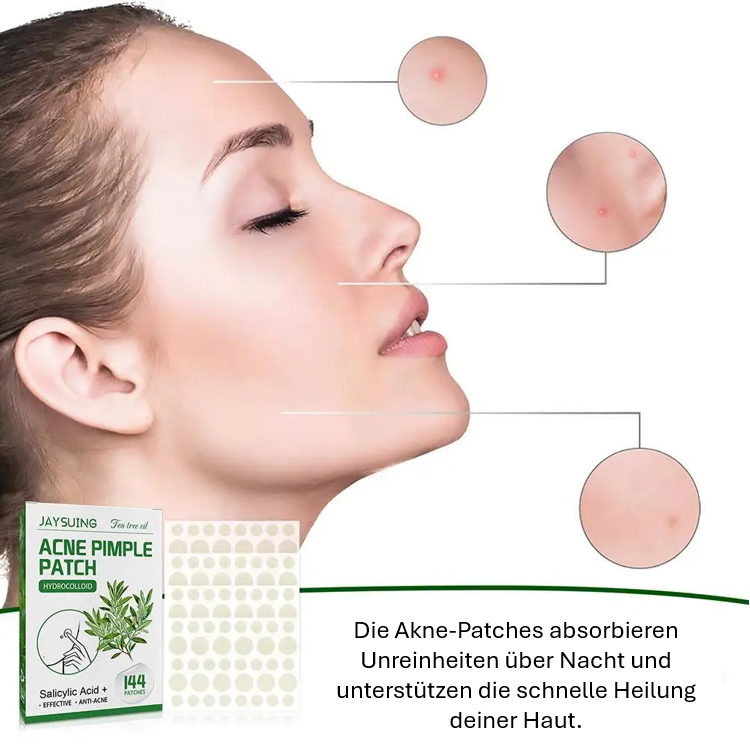 Teebaumöl Akne-Patches